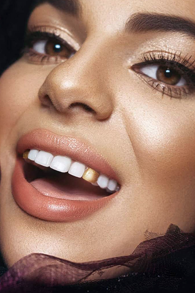 Así queda la laca de dientes dorada de Chrom.