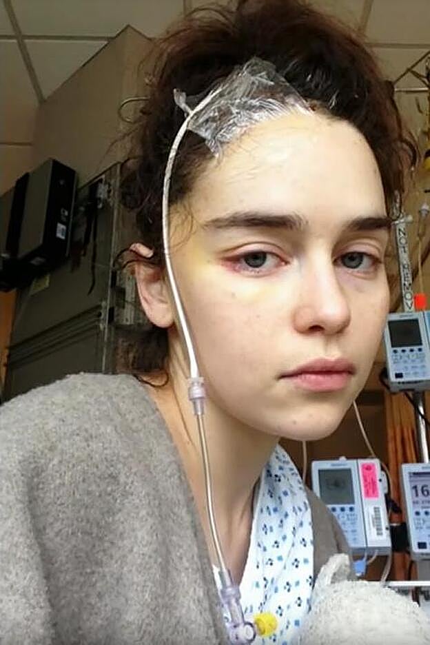 Emilia Clarke muestra cómo fueron esos días en el hospital.