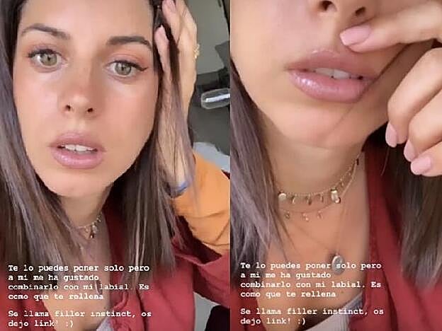 El resultado después de utilizar el plumper.