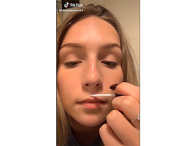 La joven Chloe Hammock es quien ha hecho viral el truco del pegamento para hacer que los labios parezcan más voluminosos.