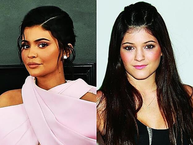 Kylie Jenner.