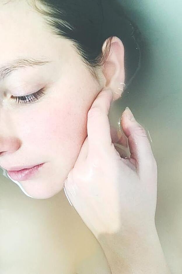 La hidratación es clave durante los brotes de rosácea.