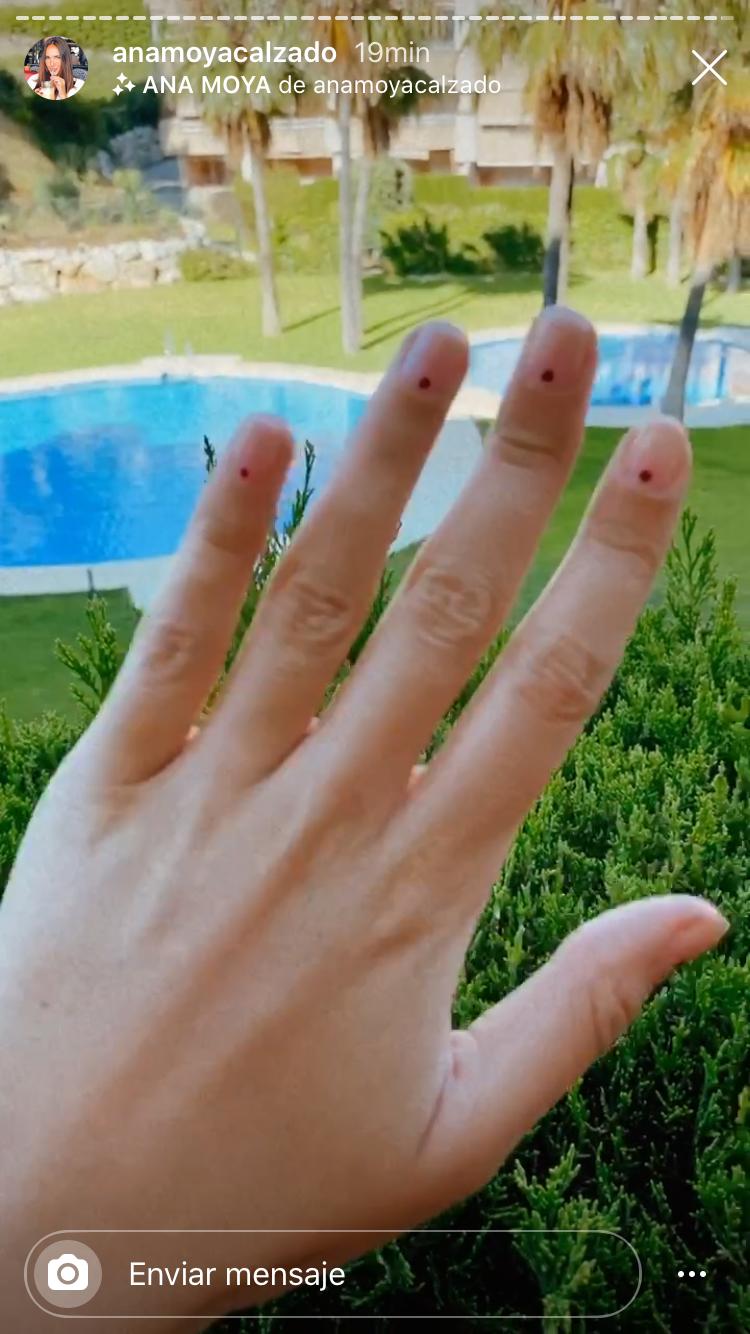 Ana Moya con esmalte transparente y puntos.