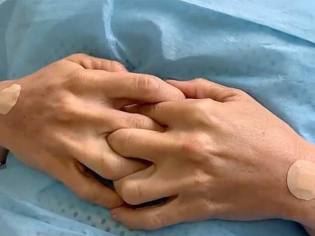 Las manos de María tras esa primera sesión para rejuvenercelas con ácido hialurónico.