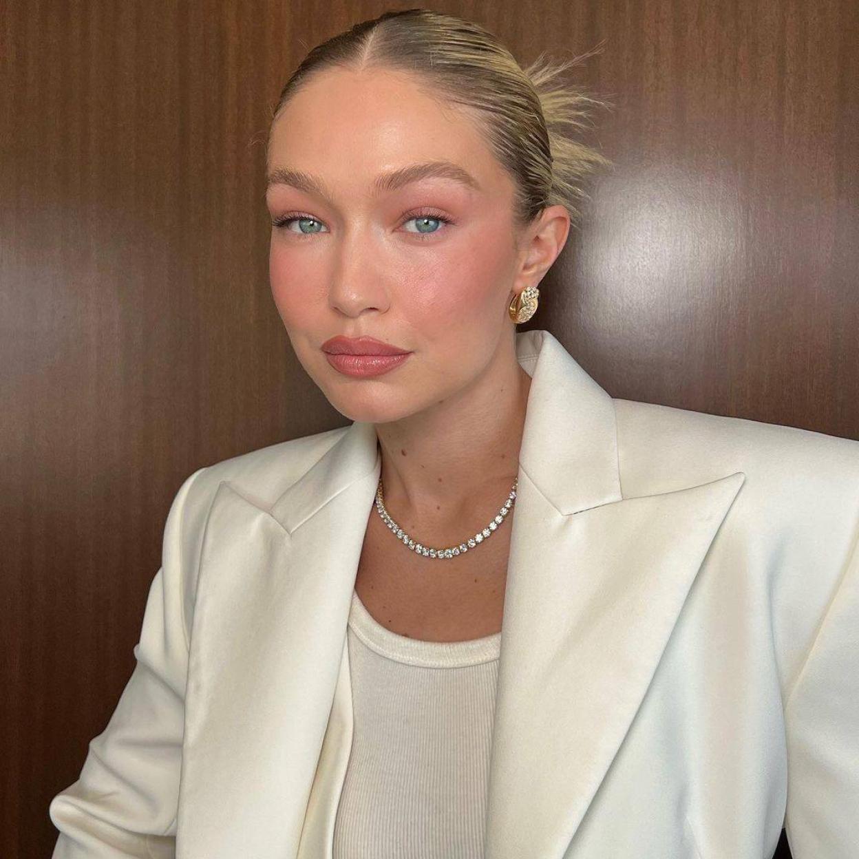 La modelo Gigi Hadid presume de una piel rellena