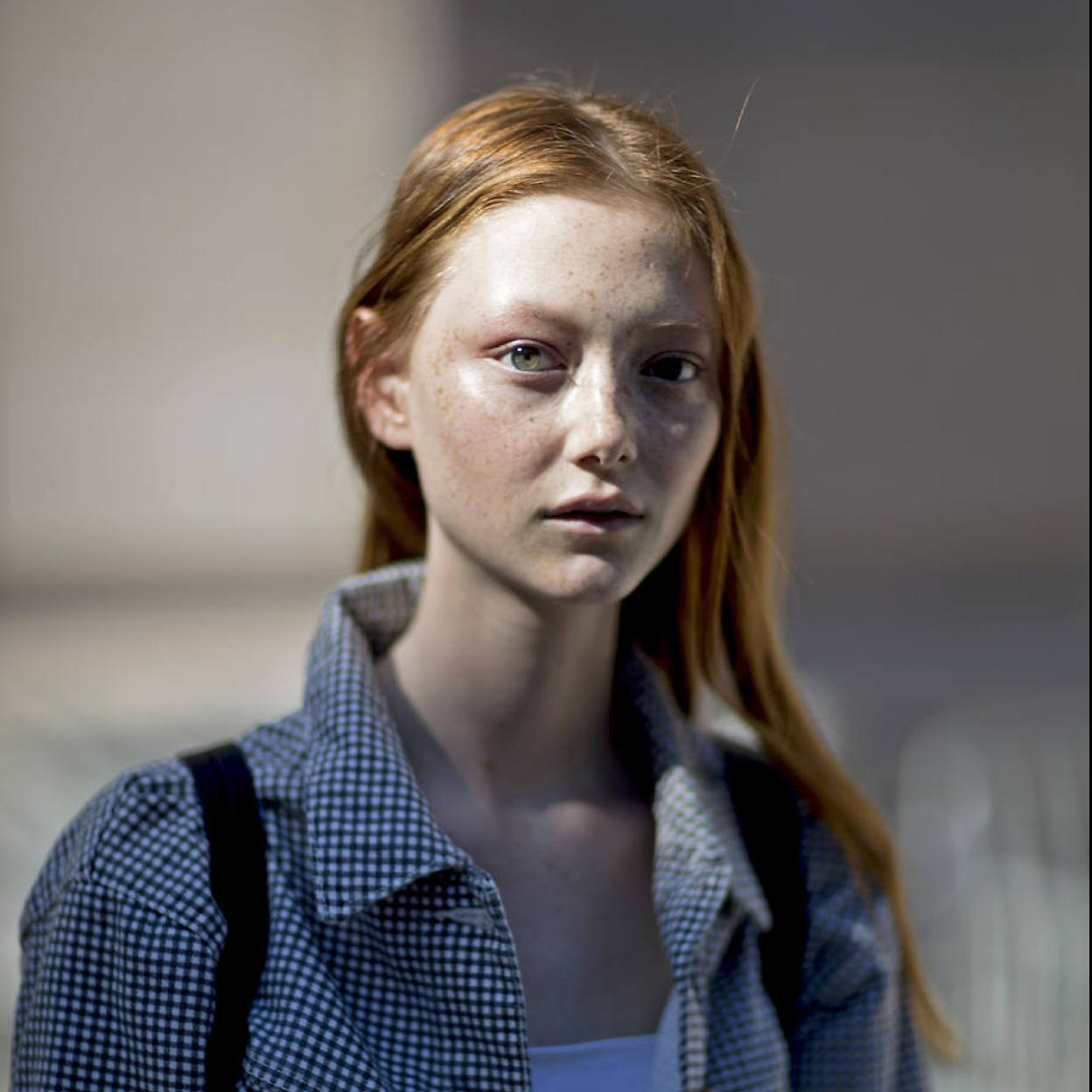 Modelo con manchas en la cara