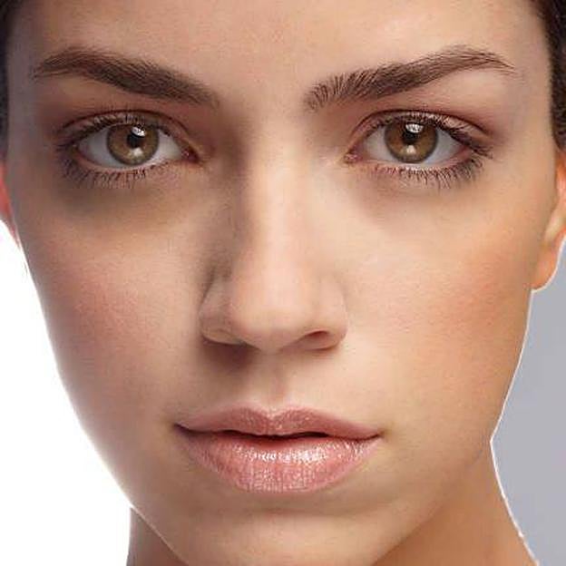 Mujer con ojeras hiperpigmetadas