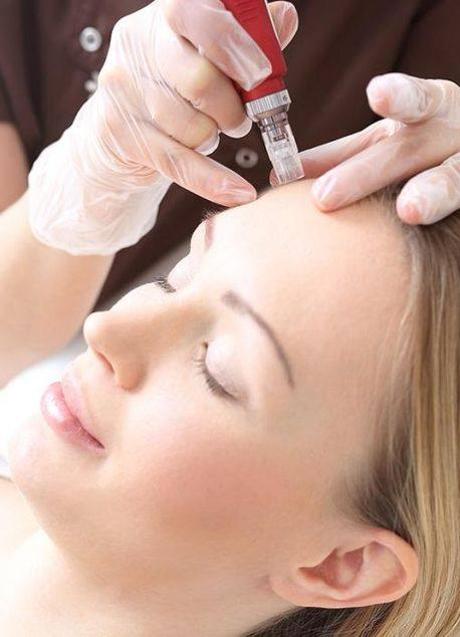 Imagen - Tratamiento flash de mesoterapia