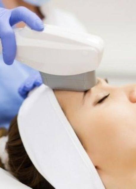 Imagen - Tratamiento de IPL para preparar la piel para bodas