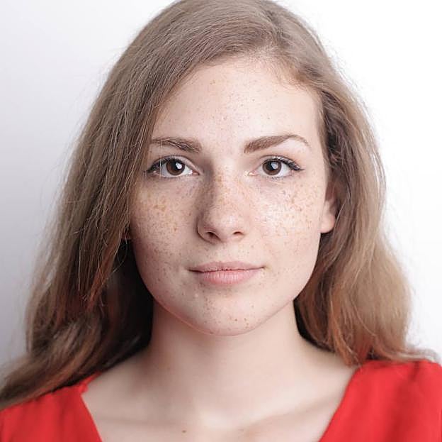 Mujer con manchas en la cara