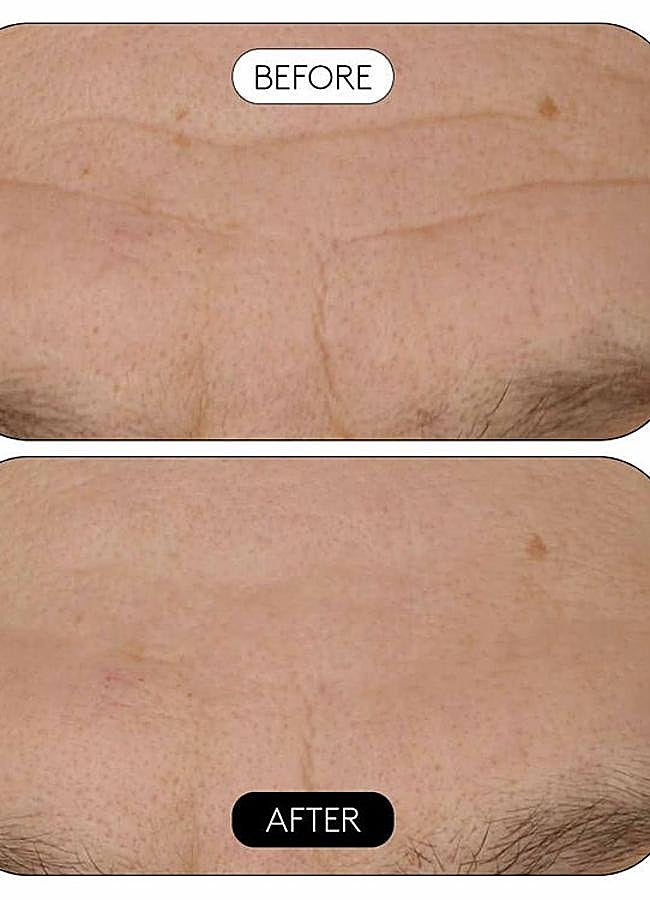 Imagen - El antes y el después.