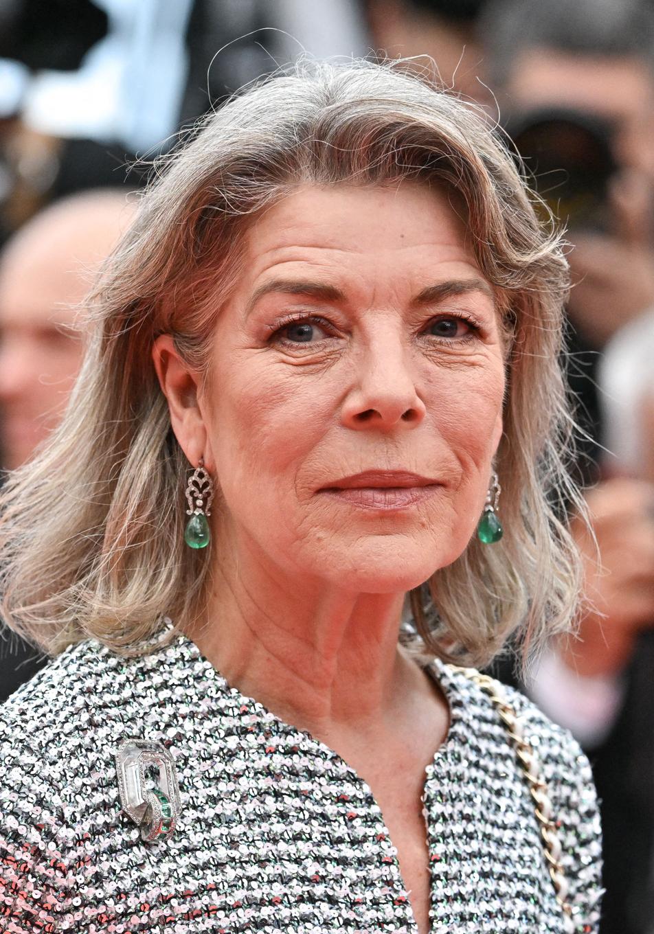 Cuero cabelludo sensible a los 60: ¿qué productos se deben usar?