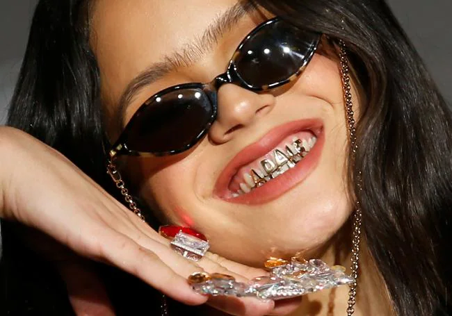 La moda de los Grillz o dientes de oro - Correa Dental