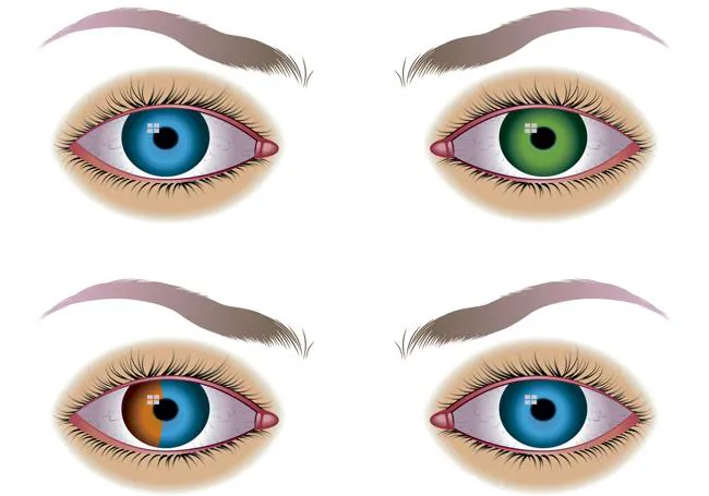 El color de los ojos se puede cambiar de forma permanente?