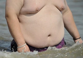 Los médicos reclaman que la obesidad sea vista y tratada como una enfermedad