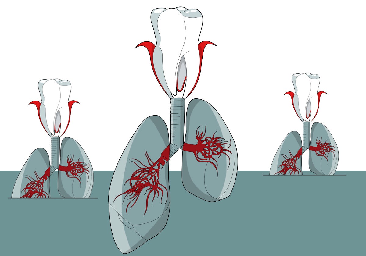 Cuida tus encías y cuidarás tus pulmones