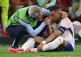 Kylian Mbappé, tras el golpe en el que se lastimó la nariz.