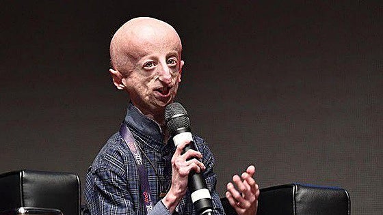 Muere a los 28 años Sammy Basso, el científico que investigaba para frenar su envejecimiento relámpago