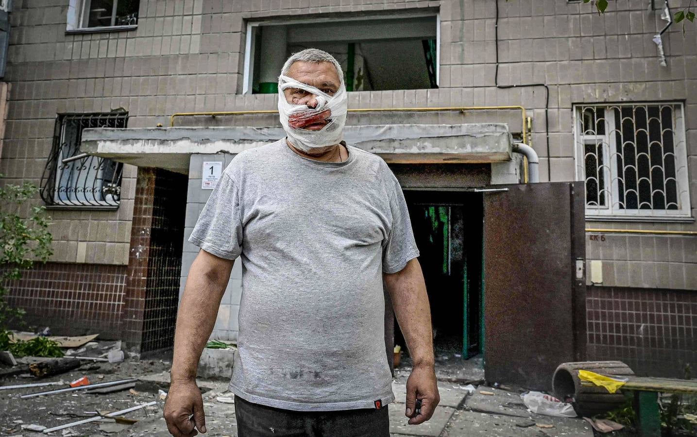 Las terribles imágenes del bombardeo ruso sobre Kiev