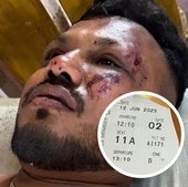 Un superviviente del avión estrellado en India relata lo ocurrido: «30 segundos después del despegue se escuchó un fuerte ruido...»
