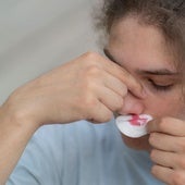 Si sangras por la nariz, ¿cómo colocar la cabeza?