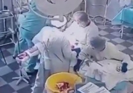 Los médicos en plena operación.