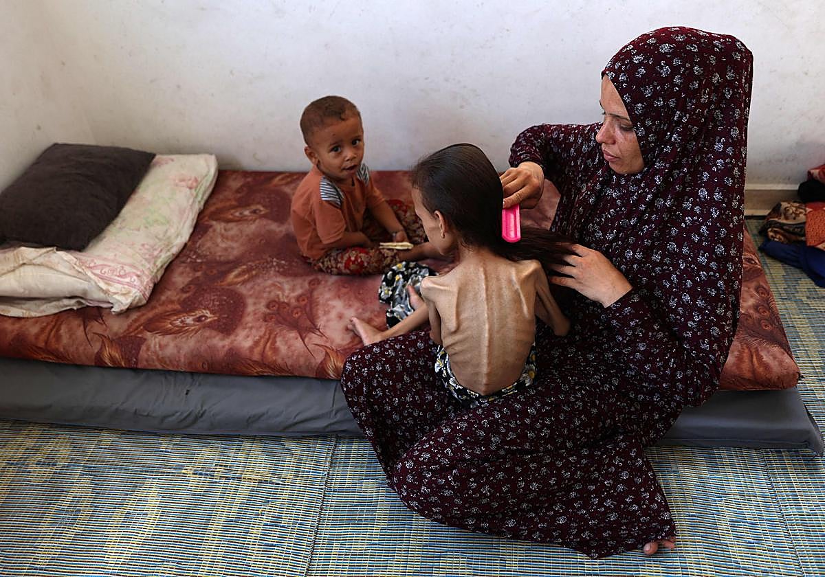 Una madre gazatí peina a su hija, víctima de inanición.