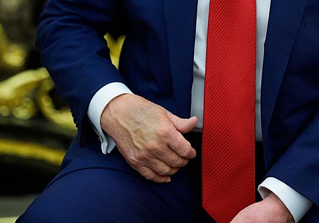 El hematoma en la mano de Trump que desató todo tipo de rumores.