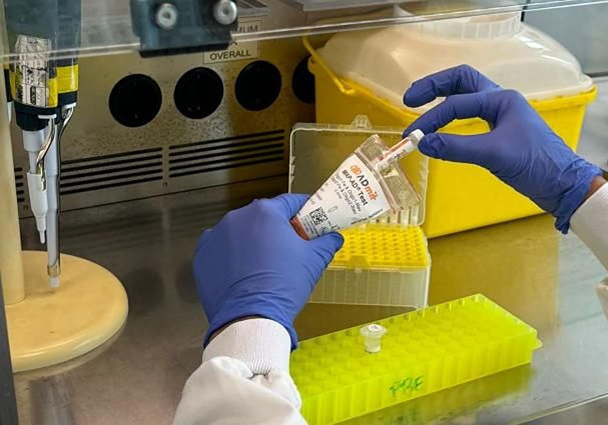 El test sanguíneo MAP-AD® de la compañía ADmit Therapeutics, que predice el alzhéimer.