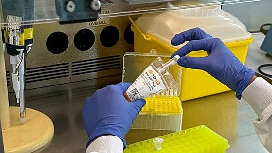 Nace el primer test en sangre que permite adelantarse al desarrollo del alzhéimer