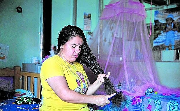 Sonia perdió los tres dedos de su mano izquierda manejando explosivos.
