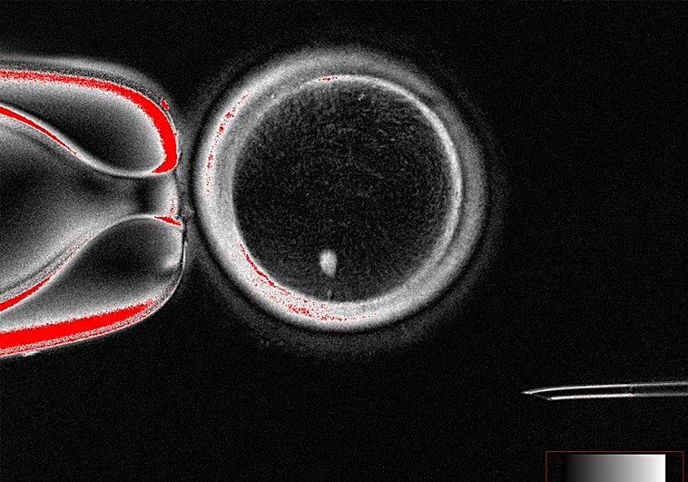 Hito en la genética: logran óvulos fecundables a partir de células de la piel
