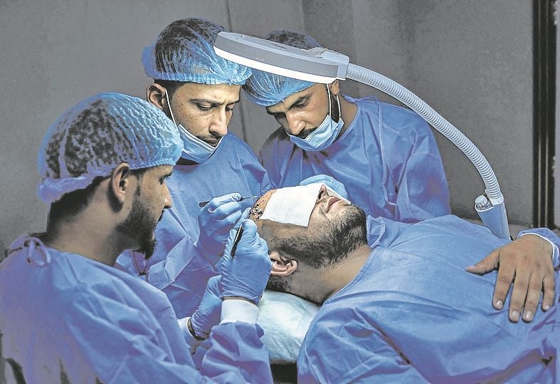 El trasplante capilar es la técnica más demandada por los hombres.