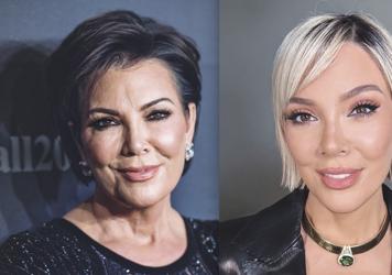 ¿Qué es el Deep Plane? La cirugía que todos quieren... pero solo pueden pagar las Kardashian