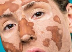 La peligrosa moda de untarse la cara con grasa de vaca: así es el ‘beef tallow’ para tratar la piel seca