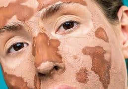 La peligrosa moda de untarse la cara con grasa de vaca: así es el ‘beef tallow’ para tratar la piel seca