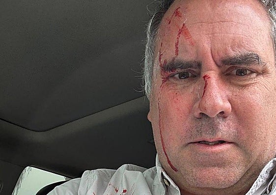 Rafael Belaúnde, con manchas de sangre.