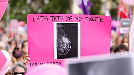 La Fiscalía de Andalucía archiva las denuncias del cribado de cáncer de mama al no haber indicios contra los altos cargos