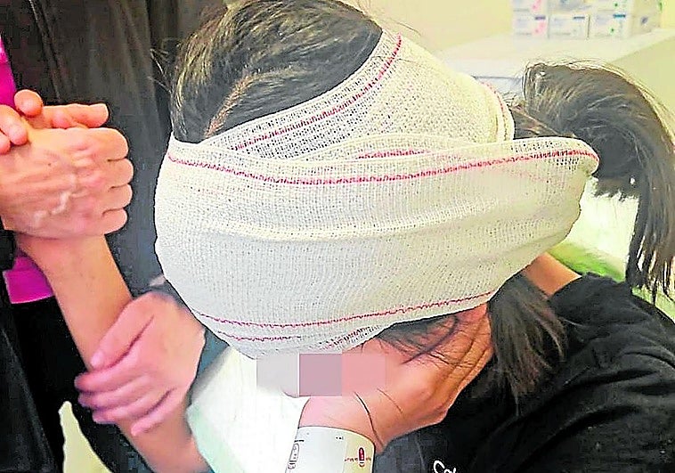 Una menor denuncia que le arrancaron parte de una oreja de un mordisco al salir de clase en Murcia