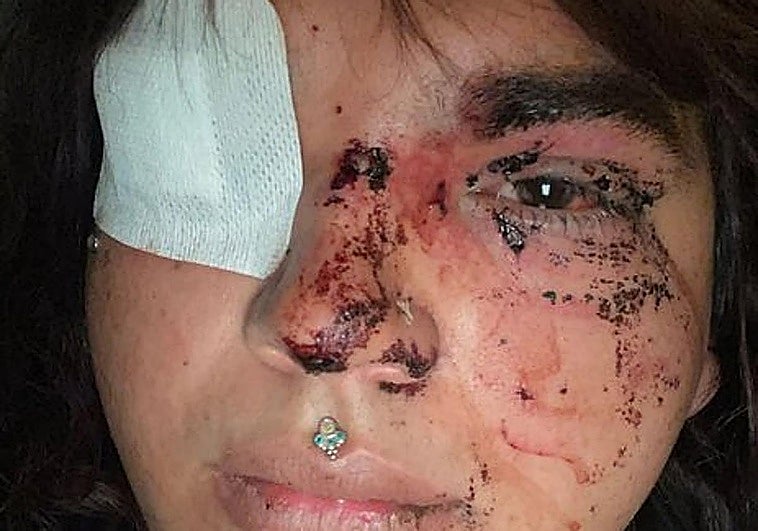Una mujer trans denuncia ser brutalmente agredida por ocho personas en León