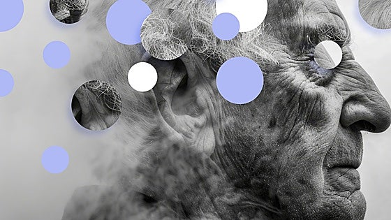 Por qué seguimos sin cura para el alzhéimer