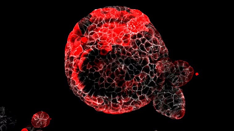 El secreto para vivir 110 años: multiplicar unas células raras que acaban con el cáncer