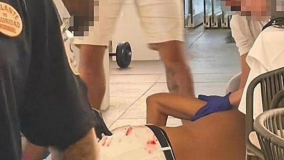 Una víctima de otro tiroteo en Málaga recibió un disparo en la cara: «Es un milagro que sobreviviera»