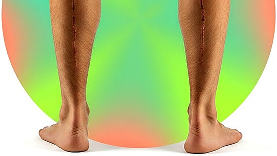 Romperte las piernas para crecer 15 centímetros: ¿hasta dónde llegarías por ser más alto?