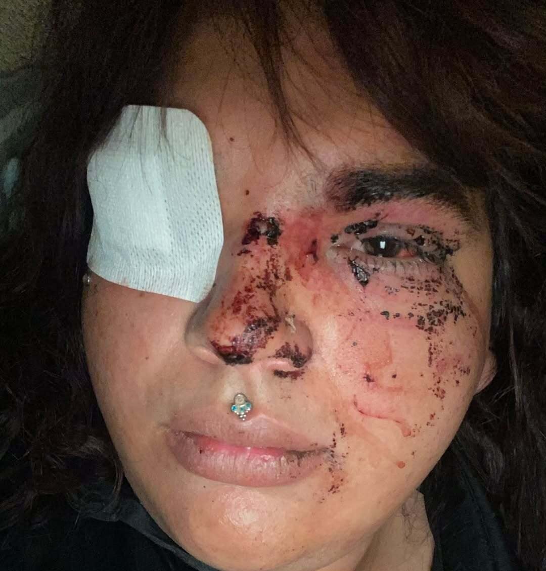 Una mujer denuncia una brutal agresión tránsfoba por diez personas en León: «Travelo, vete al baño de hombres»