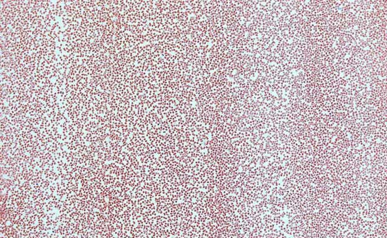 Que los glóbulos rojos sean rojos importa más de lo que parece