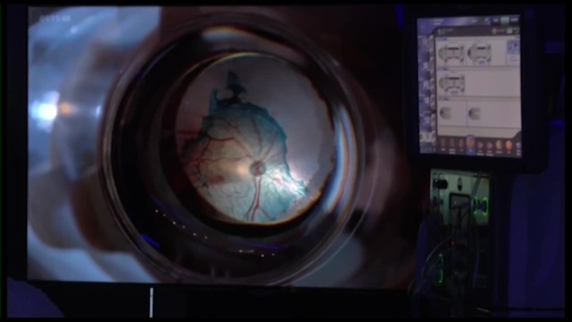 Ocho de cada diez españoles creen que la visión es importante para un envejecimiento activo