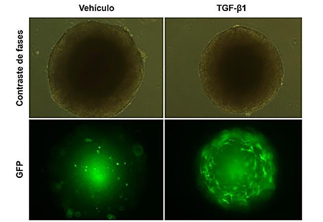 Imagen de esferoides mixtos formados por células tumorales y células hepáticas estrelladas.