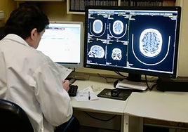 Pantalla con pruebas radiológicas.