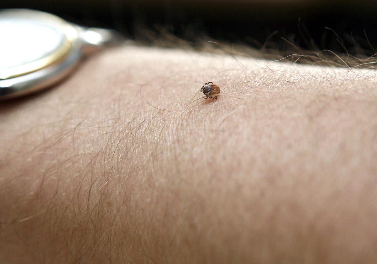 Una garrapata, en el brazo de una persona en una imagen de archivo.